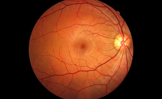 Retinal Pictures